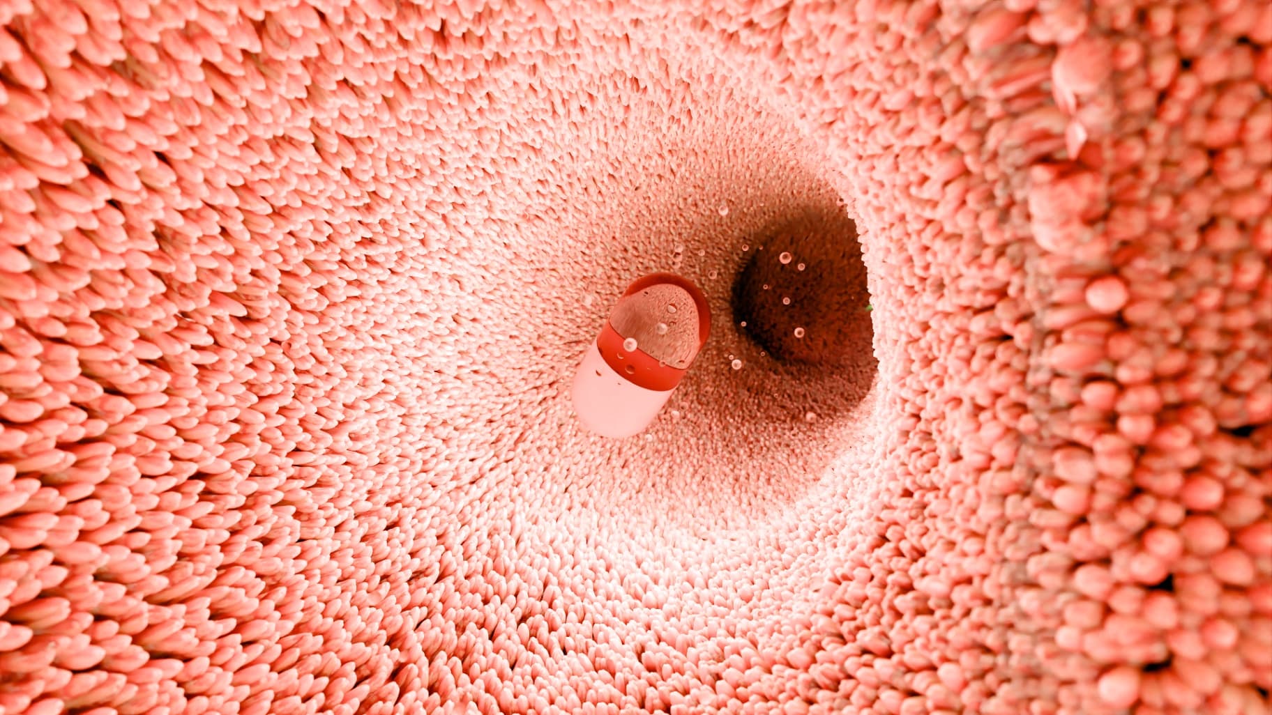 Video capsule endoscopy inside the intestine