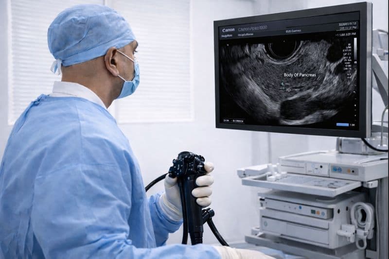 Endoscopic Ultrasound (EUS)