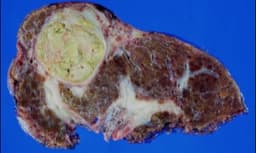 Liver & Pancreatic Cancer Screening